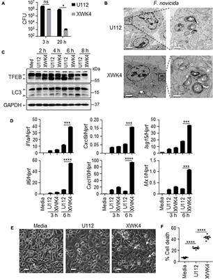 Francisella novicida Mutant XWK4 Triggers Robust Inflammasome Activation Favoring Infection